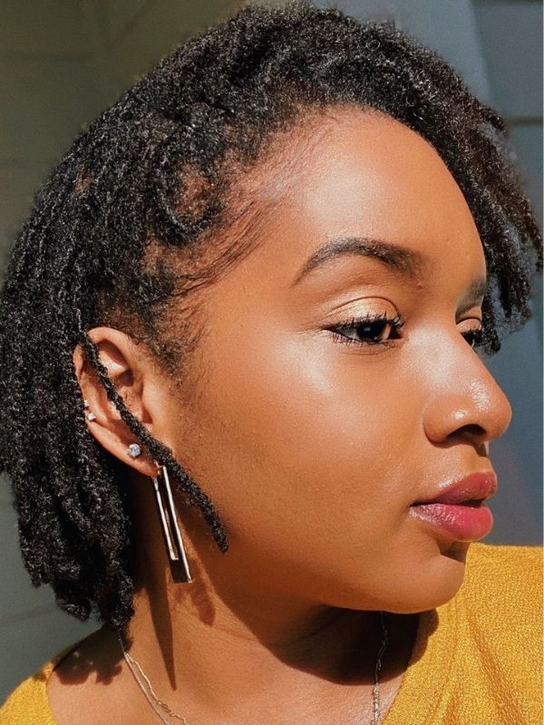 Dandruff-with-locs.