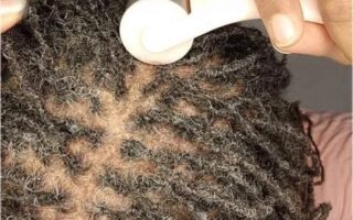 How-to-Prevent-Itching-scalp