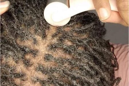 How-to-Prevent-Itching-scalp