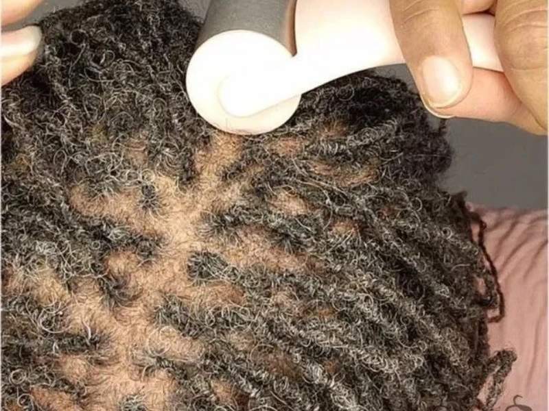 How-to-Prevent-Itching-scalp