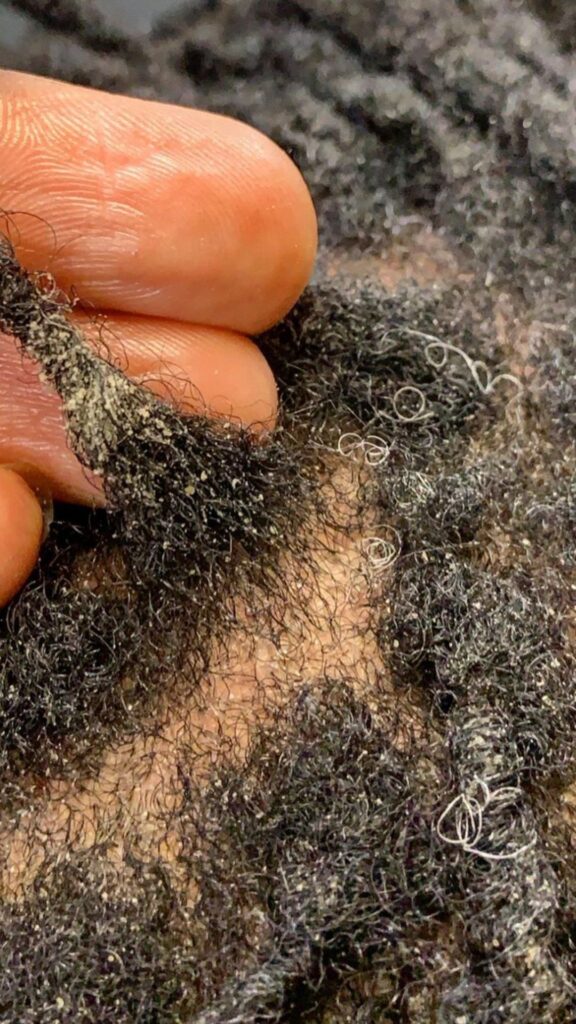 Signs-your-locs-may-need-a-deep-cleanse