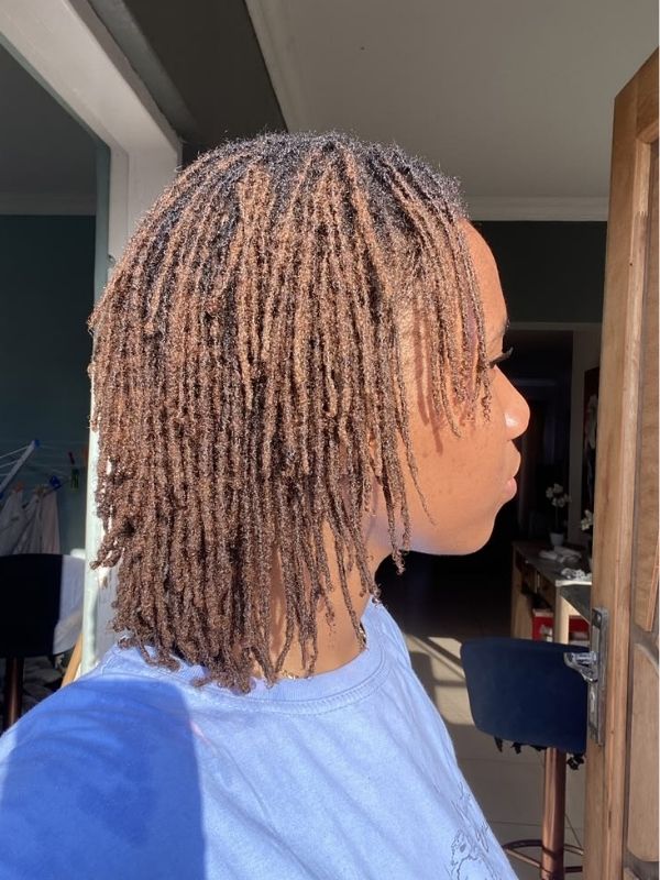 What-Really-Causes-Dandruff-With-Locs