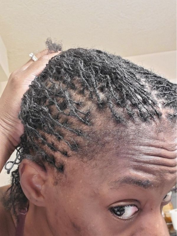 When-to-know-your-locs-is-thinning