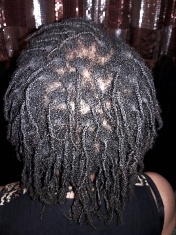An-Image-of-woman-showing-her-thinning-locs